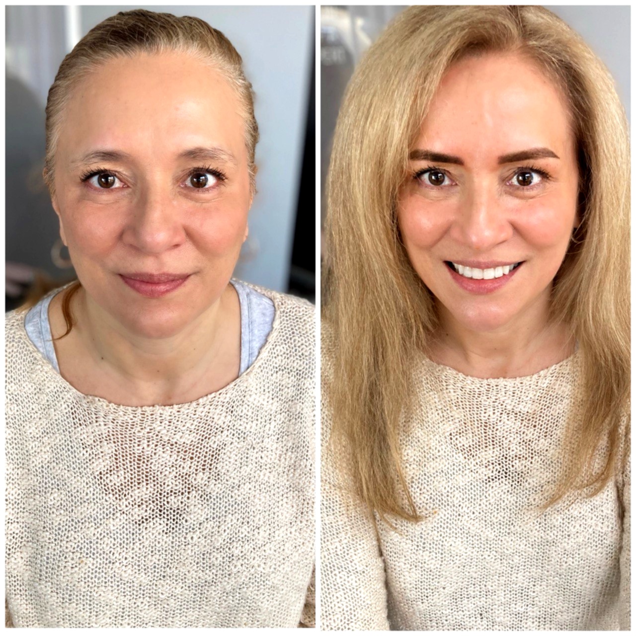 Side-by-side beauty treatment portraits, comparison 2