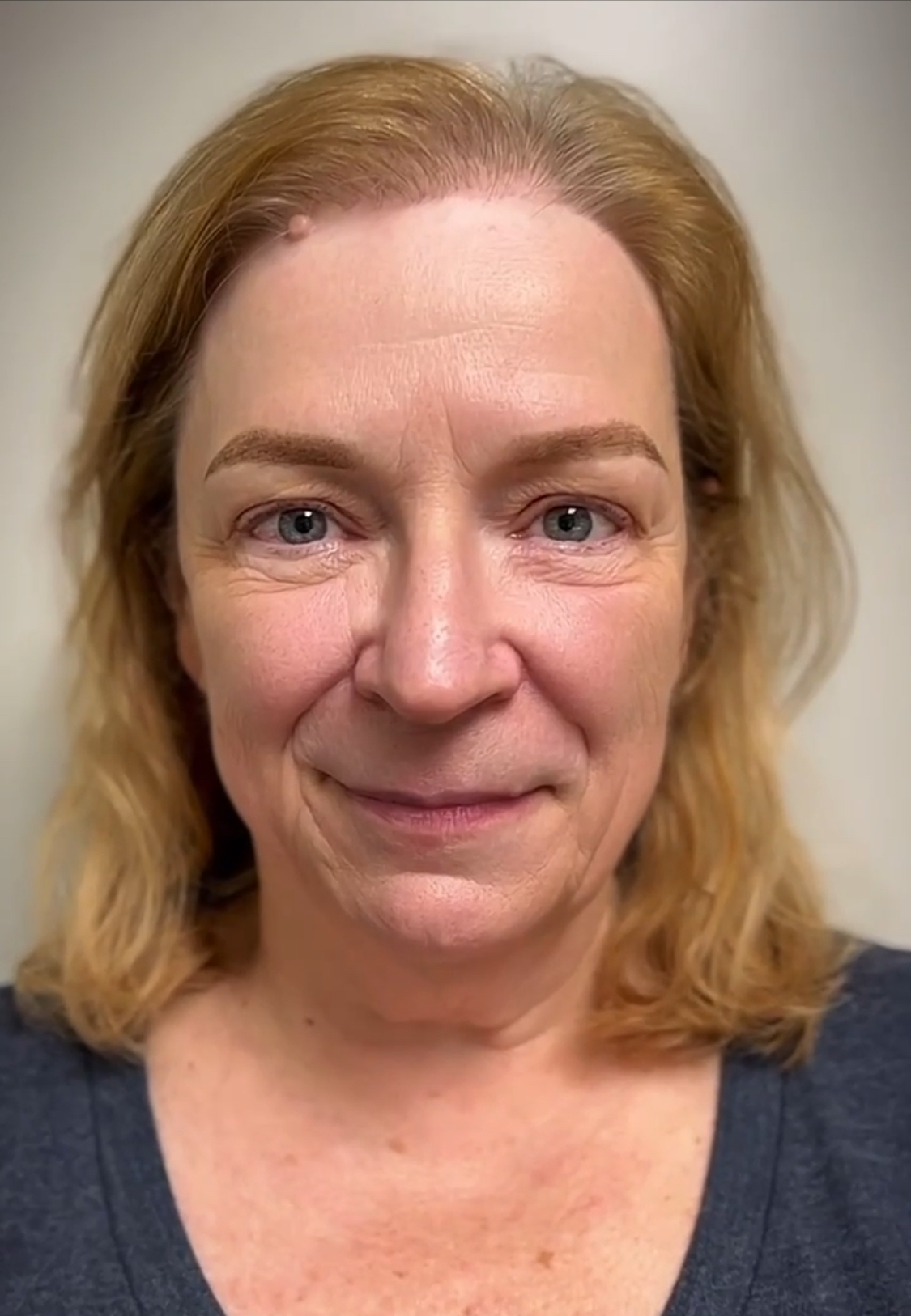 After facial treatment portrait