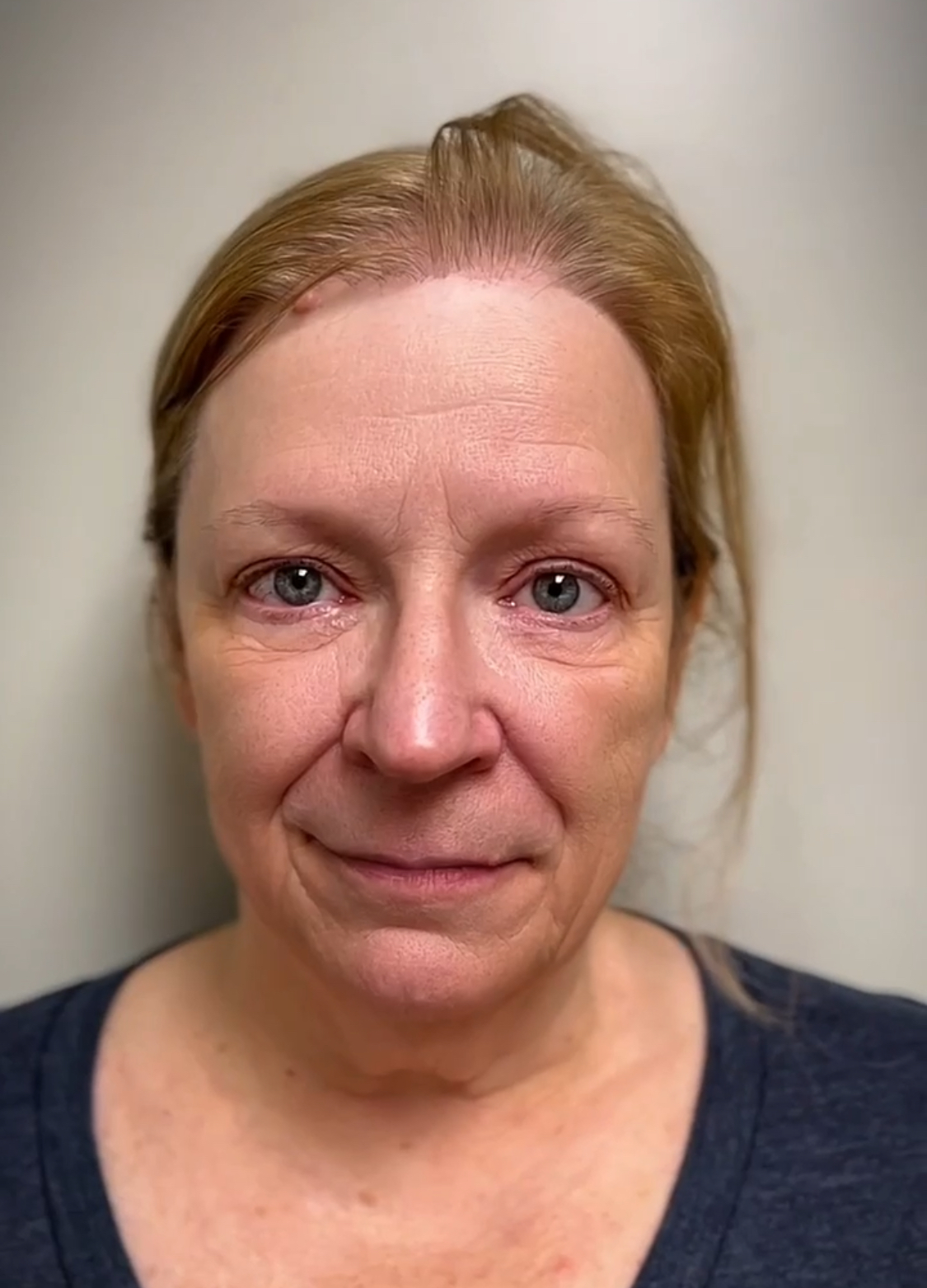 Before facial treatment portrait
